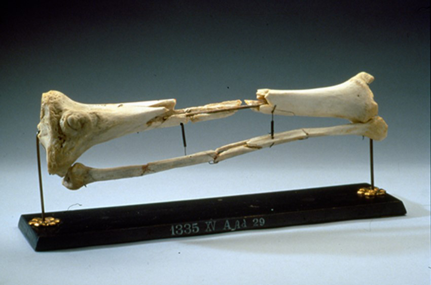 Photograph courtesy of the National Museum of Health and Medicine